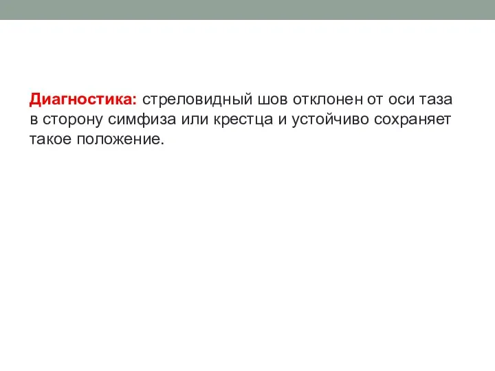 Диагностика: стреловидный шов отклонен от оси таза в сторону симфиза