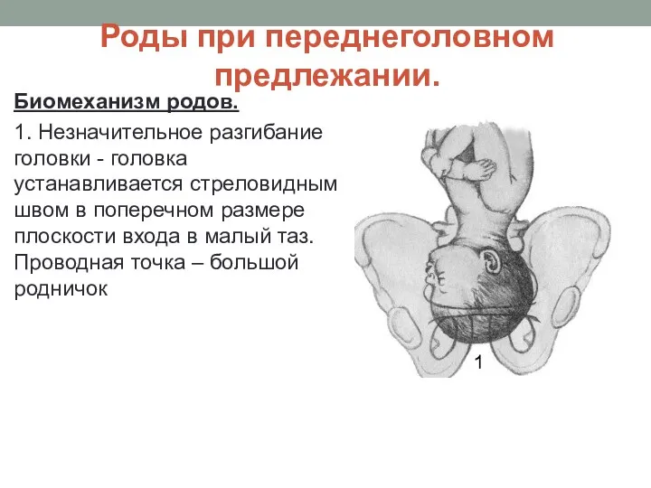 Роды при переднеголовном предлежании. Биомеханизм родов. 1. Незначительное разгибание головки