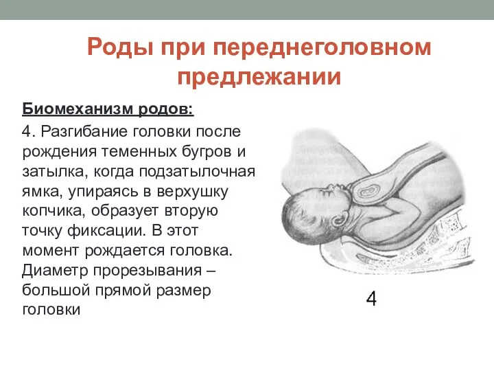 Роды при переднеголовном предлежании Биомеханизм родов: 4. Разгибание головки после