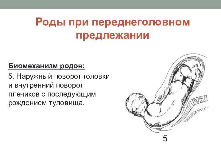 Роды при переднеголовном предлежании Биомеханизм родов: 5. Наружный поворот головки