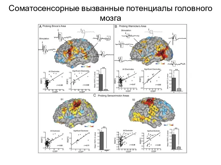 Соматосенсорные вызванные потенциалы головного мозга