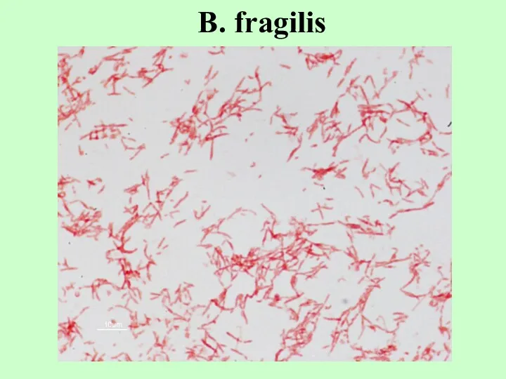 B. fragilis