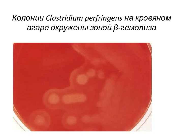 Колонии Clostridium perfringens на кровяном агаре окружены зоной β-гемолиза