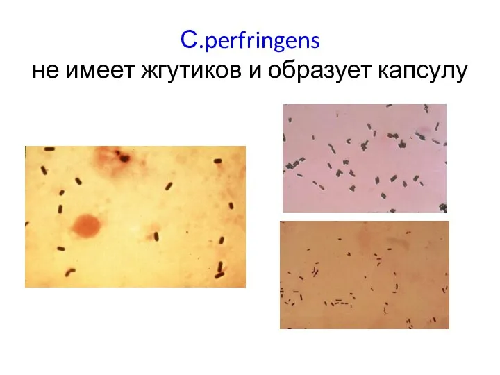 С.perfringens не имеет жгутиков и образует капсулу