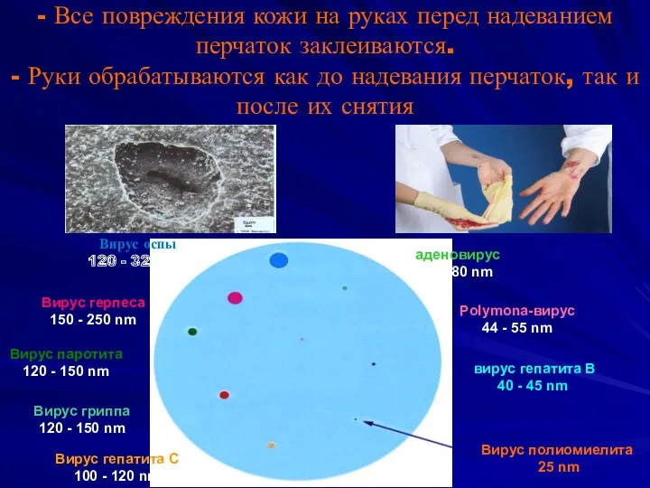 - Все повреждения кожи на руках перед надеванием перчаток заклеиваются.