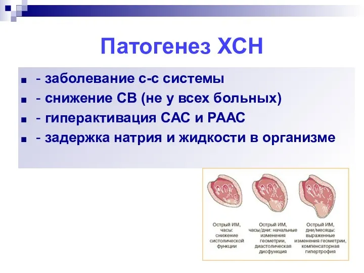 Патогенез ХСН - заболевание с-с системы - снижение СВ (не