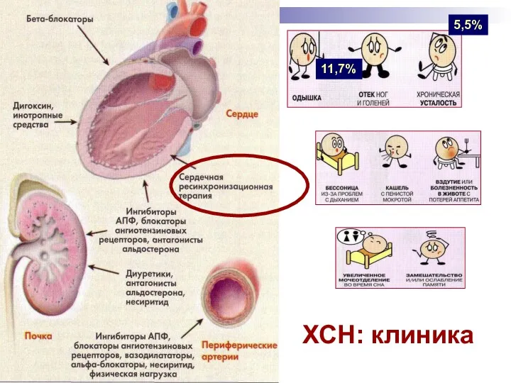 ХСН: клиника 11,7% 5,5%