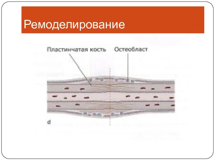 Ремоделирование