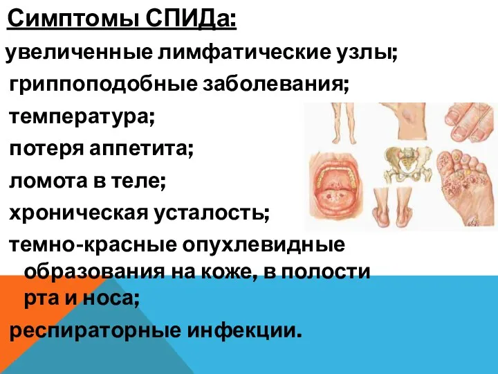 Симптомы СПИДа: увеличенные лимфатические узлы; гриппоподобные заболевания; температура; потеря аппетита;