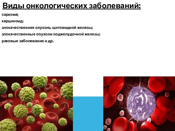 Виды онкологических заболеваний: саркома; карциноид; злокачественная опухоль щитовидной железы; злокачественные