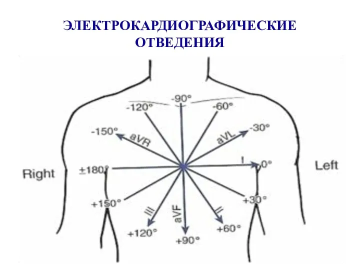 ЭЛЕКТРОКАРДИОГРАФИЧЕСКИЕ ОТВЕДЕНИЯ