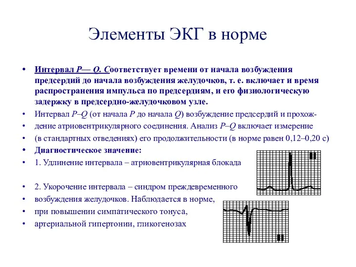 Элементы ЭКГ в норме Интервал Р— Q. Соответствует времени от