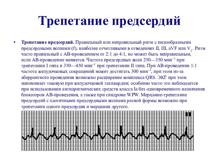 Трепетание предсердий Трепетание предсердий. Правильный или неправильный ритм с пилообразными