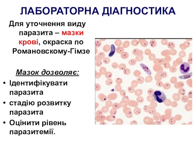 ЛАБОРАТОРНА ДІАГНОСТИКА Для уточнення виду паразита – мазки крові, окраска