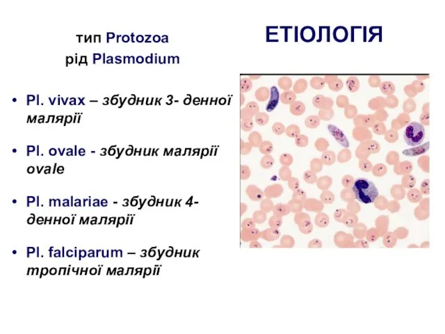 ЕТІОЛОГІЯ тип Protozoa рід Plasmodium Pl. vivax – збудник 3-