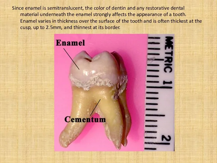 Since enamel is semitranslucent, the color of dentin and any