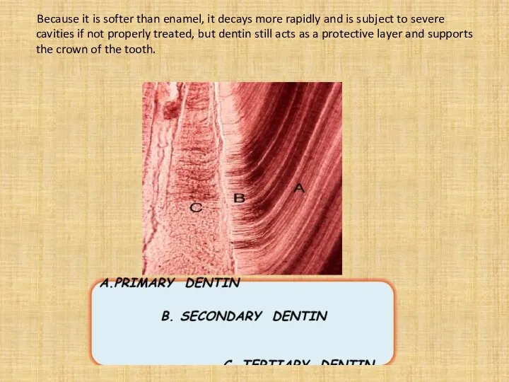 Because it is softer than enamel, it decays more rapidly