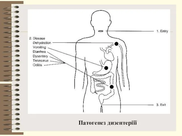 Патогенез дизентеріїї