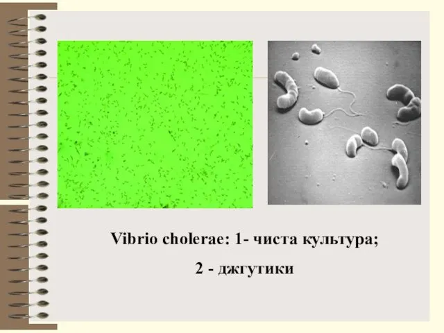 Vibrio cholerae: 1- чиста культура; 2 - джгутики