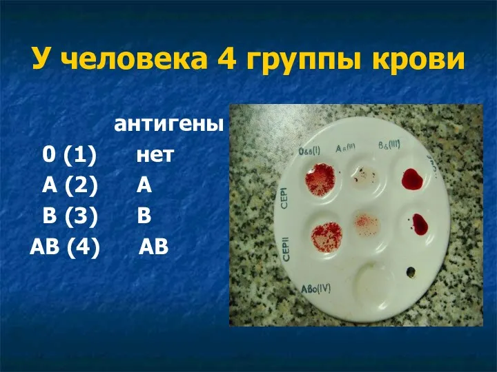 У человека 4 группы крови антигены 0 (1) нет А