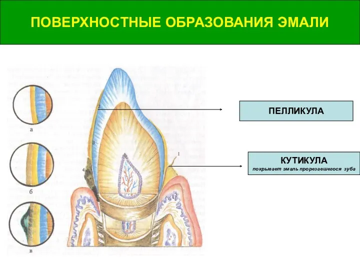 ПОВЕРХНОСТНЫЕ ОБРАЗОВАНИЯ ЭМАЛИ ПОВЕРХНОСТНЫЕ ОБРАЗОВАНИЯ ЭМАЛИ КУТИКУЛА покрывает эмаль прорезавшегося зуба ПЕЛЛИКУЛА