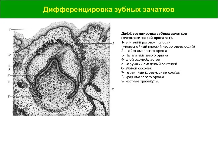 Дифференцировка зубных зачатков Дифференцировка зубных зачатков Дифференцировка зубных зачатков (гистологический