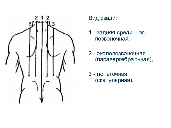 Вид сзади: 1 - задняя срединная, позвоночная, 2 - околопозвоночная (паравертебральная), 3 - лопаточная (скапулярная).