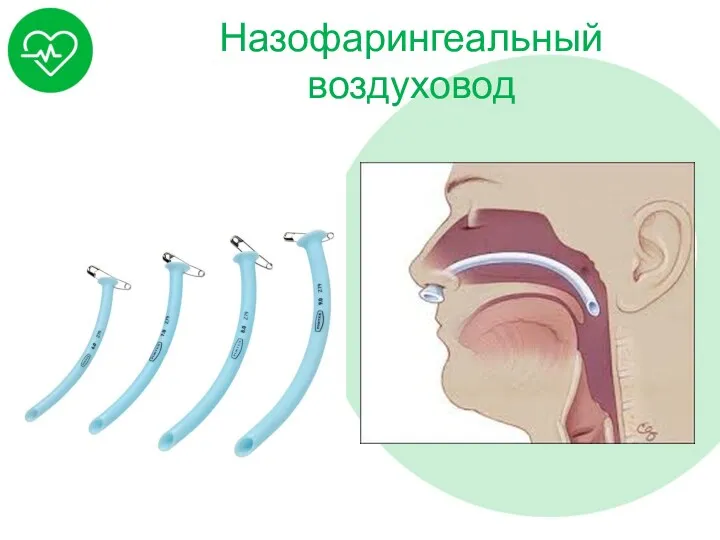 Назофарингеальный воздуховод