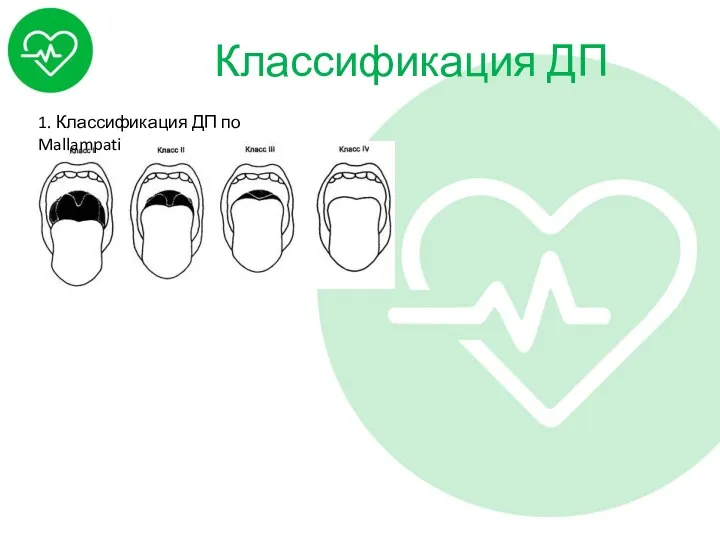 Классификация ДП 1. Классификация ДП по Mallampati