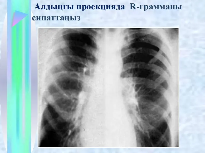 Алдыңғы проекцияда R-грамманы сипаттаңыз