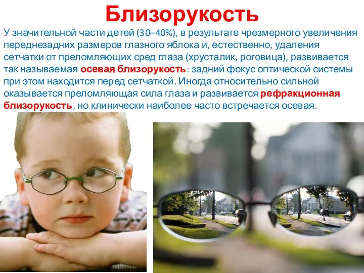 Близорукость У значительной части детей (30–40%), в результате чрезмерного увеличения переднезадних размеров глазного