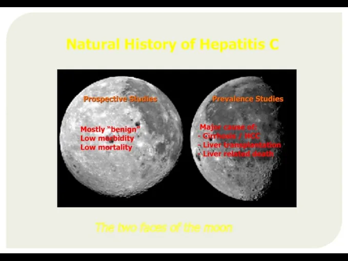 Natural History of Hepatitis C The two faces of the moon