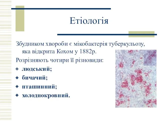Етіологія Збудником хвороби є мікобактерія туберкульозу, яка відкрита Кохом у 1882р. Розрізняють чотири