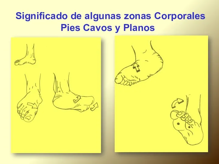 Significado de algunas zonas Corporales Pies Cavos y Planos