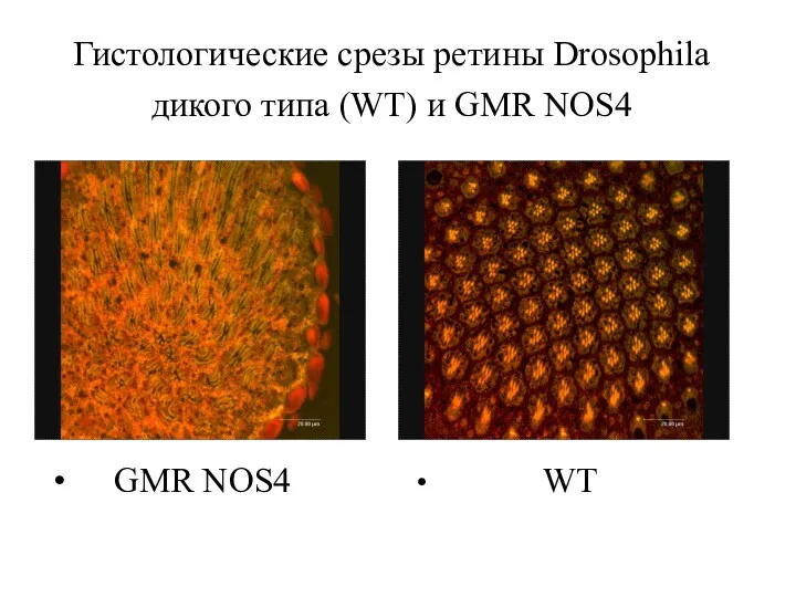Гистологические срезы ретины Drosophila дикого типа (WT) и GMR NOS4 GMR NOS4 WT