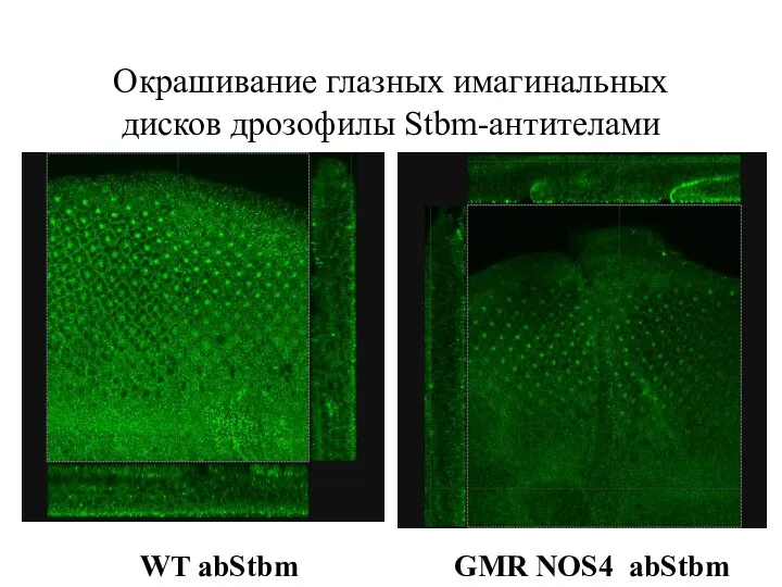 Окрашивание глазных имагинальных дисков дрозофилы Stbm-антителами GMR NOS4 abStbm WT abStbm