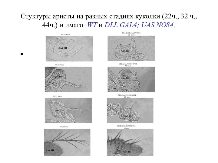 Стуктуры аристы на разных стадиях куколки (22ч., 32 ч., 44ч.) и имаго WT