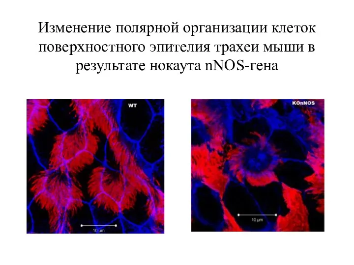 Изменение полярной организации клеток поверхностного эпителия трахеи мыши в результате нокаута nNOS-гена