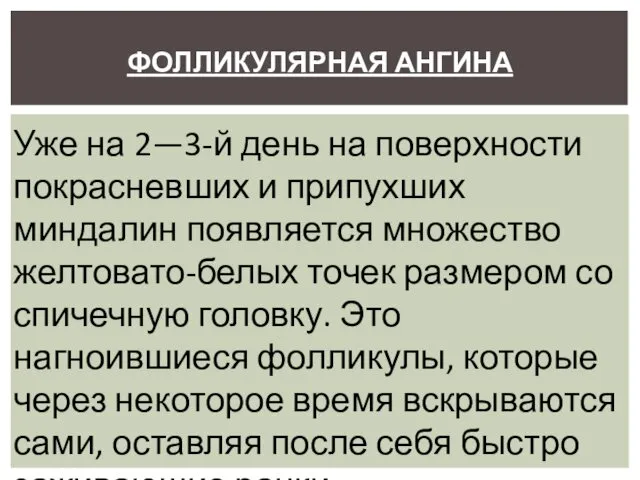 ФОЛЛИКУЛЯРНАЯ АНГИНА Уже на 2—3-й день на поверхности покрасневших и