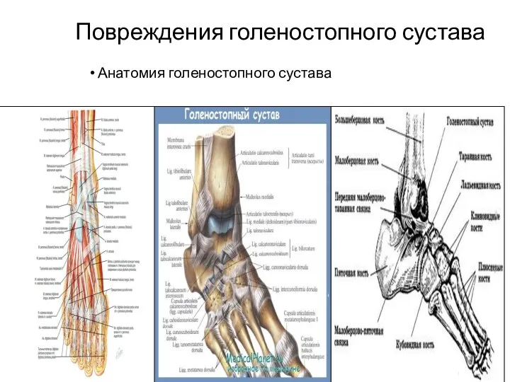 Повреждения голеностопного сустава Анатомия голеностопного сустава