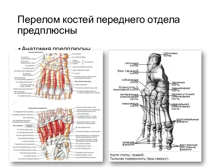 Перелом костей переднего отдела предплюсны Анатомия предплюсны