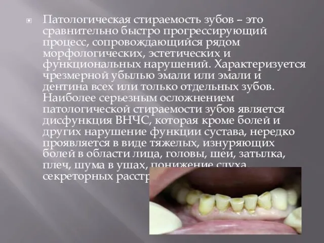 Патологическая стираемость зубов – это сравнительно быстро прогрессирующий процесс, сопровождающийся