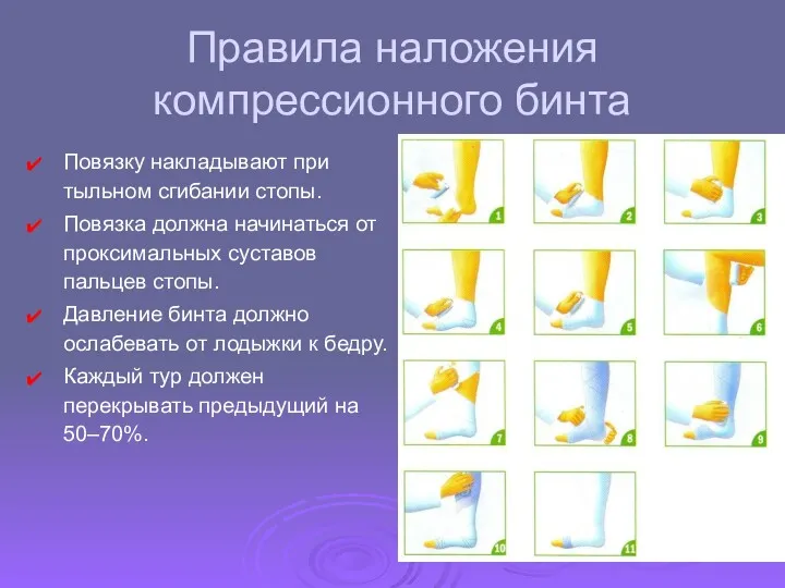 Правила наложения компрессионного бинта Повязку накладывают при тыльном сгибании стопы.