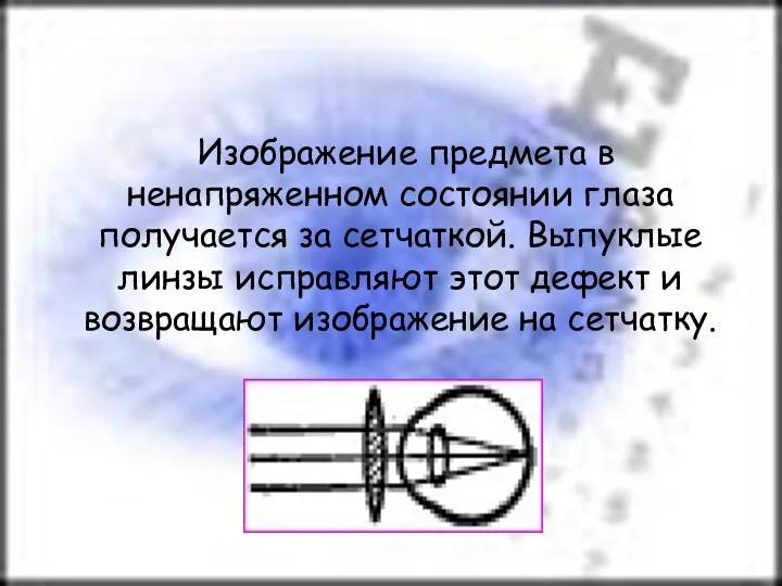 Изображение предмета в ненапряженном состоянии глаза получается за сетчаткой. Выпуклые линзы исправляют этот