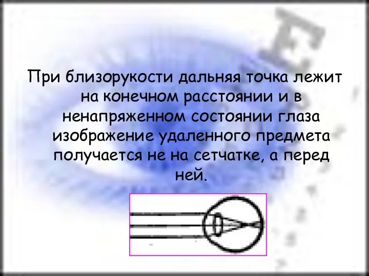 При близорукости дальняя точка лежит на конечном расстоянии и в ненапряженном состоянии глаза