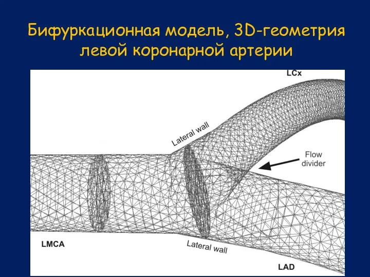 Бифуркационная модель, 3D-геометрия левой коронарной артерии