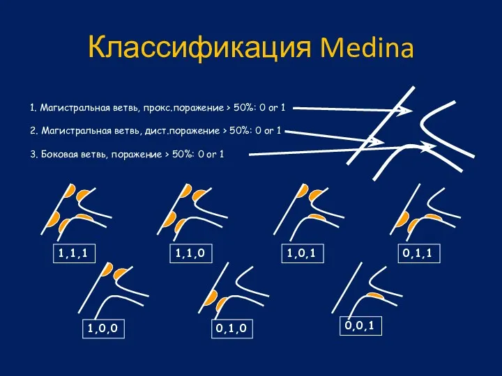 Классификация Medina 1,1,1 1,1,0 1,0,1 0,1,1 1,0,0 0,1,0 0,0,1 1.