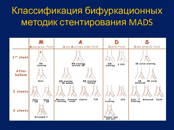 Классификация бифуркационных методик стентирования MADS