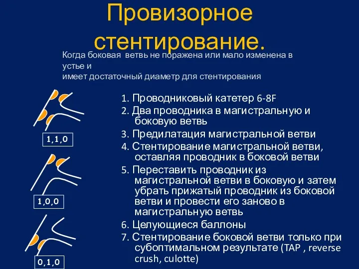 Провизорное стентирование. 1. Проводниковый катетер 6-8F 2. Два проводника в