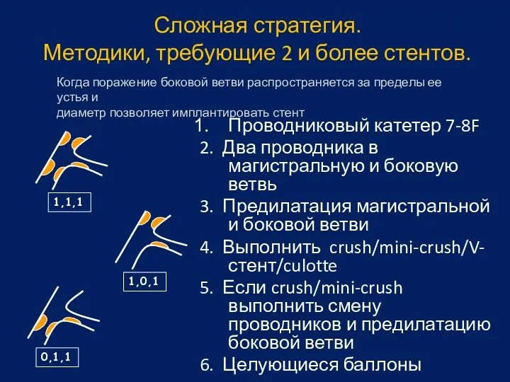 Сложная стратегия. Методики, требующие 2 и более стентов. Проводниковый катетер